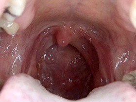 300人のおくち 第1集　サンプル画像03